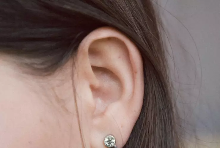 Por esta razón los expertos recomiendan NO limpiar los oídos con hisopos