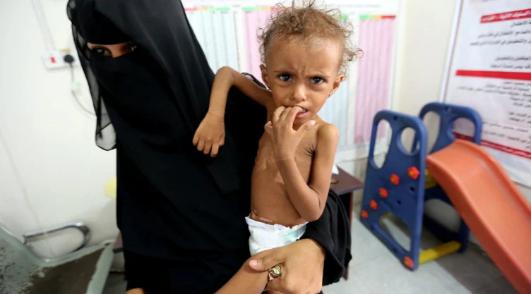 yemen niños mueren de hambre