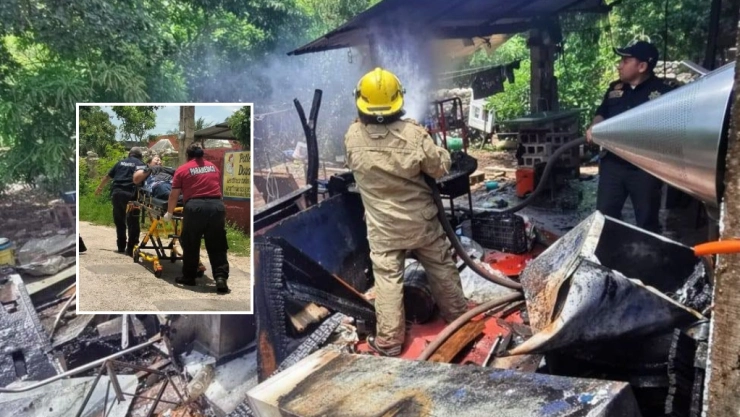 Mujer sufre QUEMADURAS DE GRAVEDAD tras flamazo de tanque de gas en Motul
