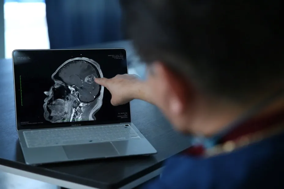 Issste tumor cerebral.jpg