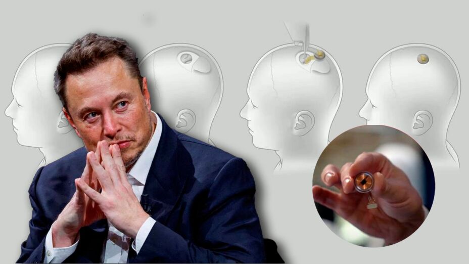 Elon Musk asegura que Neuralink ya implantó un chip cerebral en un ser humano