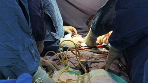 IMSS trasplante corazón