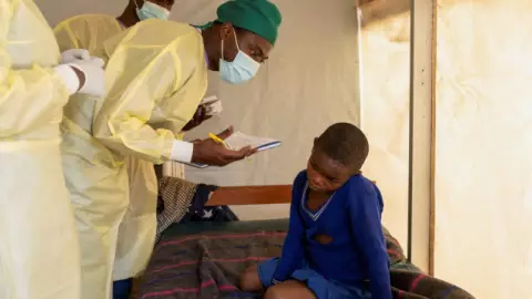 África declara emergencia de salud pública la viruela del mono