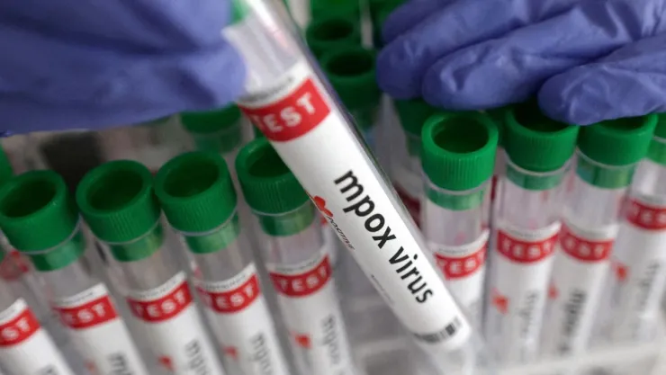 Mpox en Sonora: Nuevos Casos Confirmados