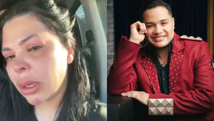 ¡Escándalo! Esposa del vocalista de Los Recoditos denuncia maltrato fue golpeada y herida con cuchillo .jpg