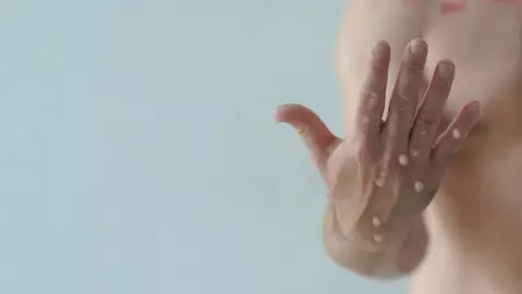 Estos son los animales que transmiten la viruela del mono