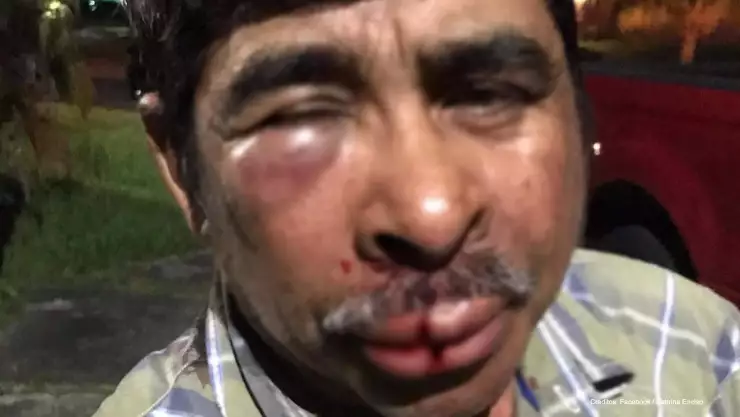 hombre mexicano golpeado miami.jpg