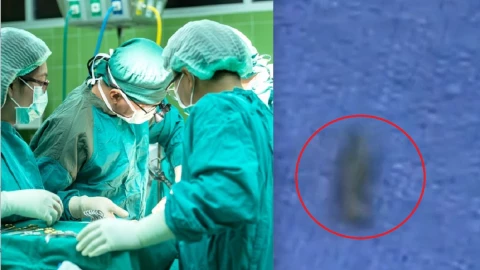 llueven gusanos caen techo encima paciente quirófano