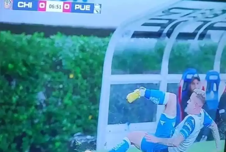 Gustavo ferrareis se fractura