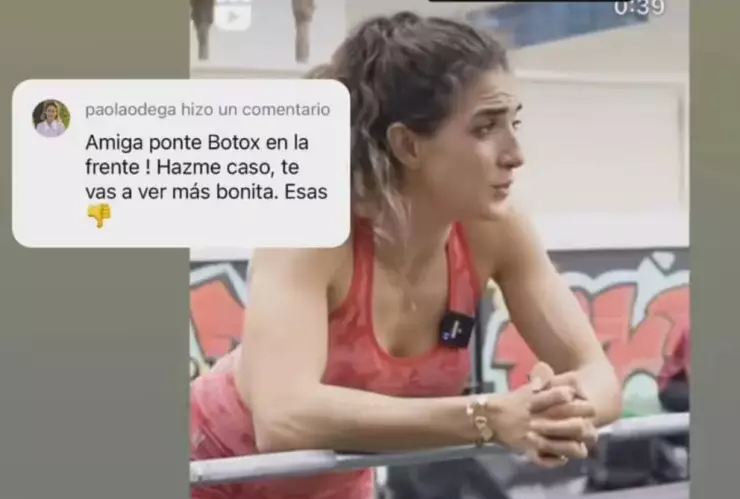 Influencer Jousfit sufre infarto cerebral tras aplicación de botox; esto es lo que se sabe de su salud.jpg