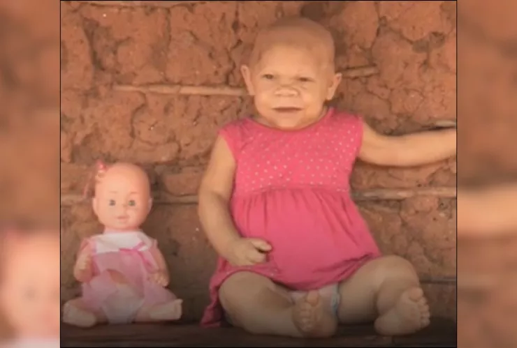 ¡Mujer de 30 años atrapada en el cuerpo de bebé recién nacida! Este es el impactante caso de María Audenete.jpg