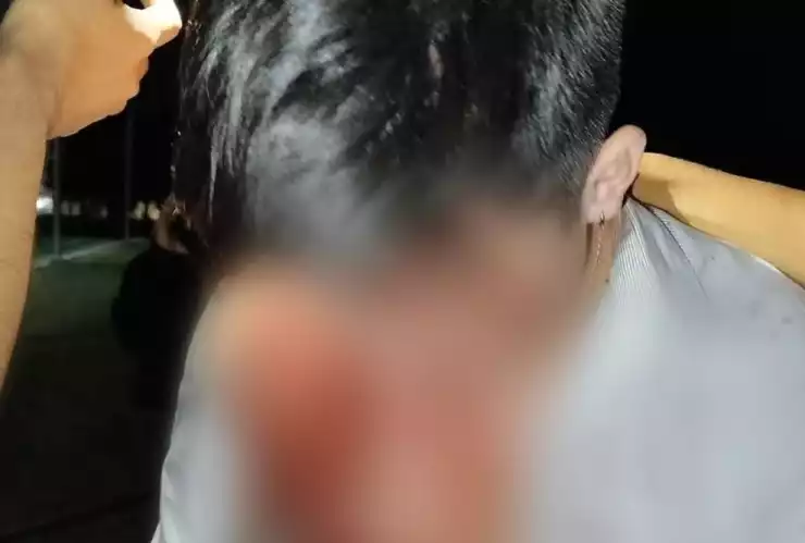 Apuñalado parque ecológico