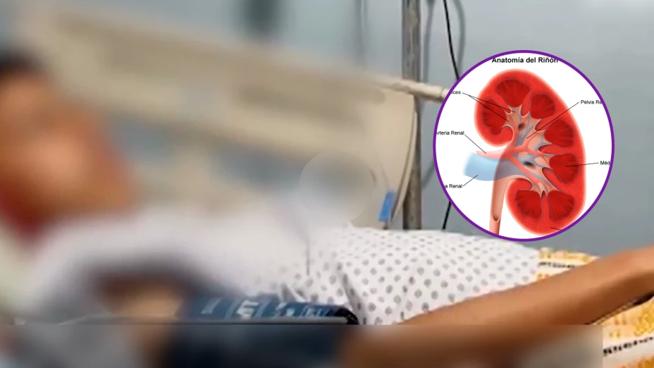 Estudiante pierde un riñón tras acoso escolar en Chiapas; escuela niega seguro médico