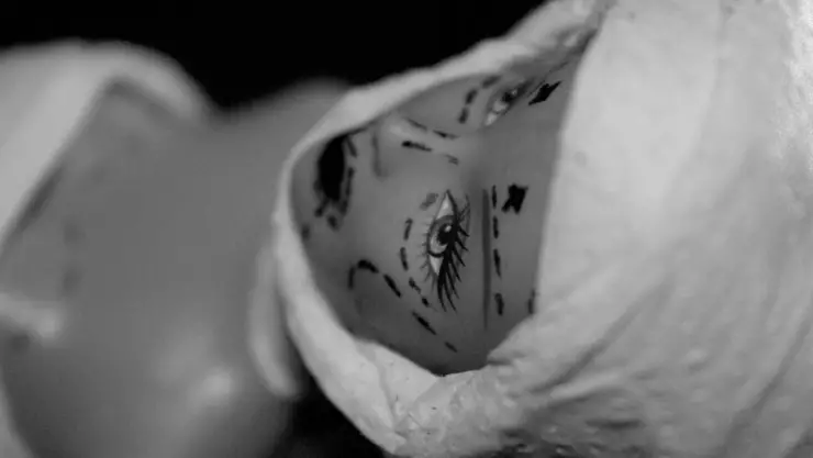 Mujer muere al realizarse 6 CIRUGÍAS estéticas en 24 HORAS; así ocurrió