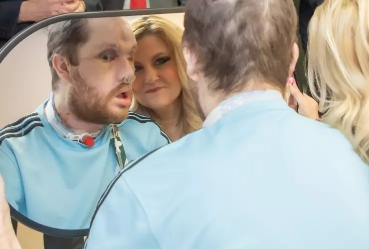 trasplante-rostro-derek-pfaff