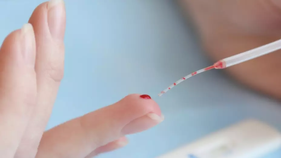 hepatitis infantil México casos