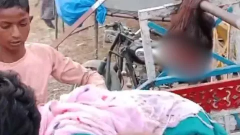 Menor pierde el cuero cabelludo en accidente