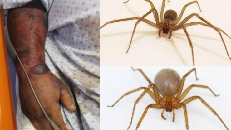 Un hombre de 50 años de edad de Salvatierra, Guanajuato, falleció luego de haber sido picado por una araña violinista.