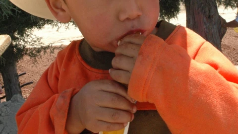 El virus de coxsackie afecta principalmente a menores de cinco años de edad.