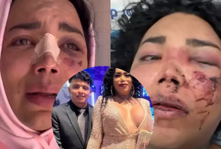 “Pensé que todo era un sueño”_ Paola Suárez reaparece tras sufrir agresión de su novio.jpg