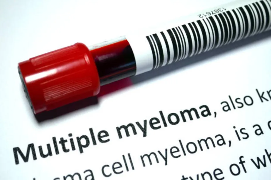 Mieloma Múltiple cortesía AMLCC.jpg
