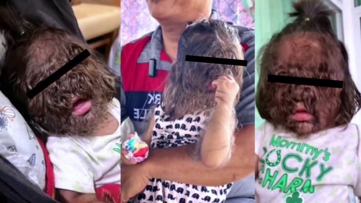 Niña lobo inquieta en redes sociales