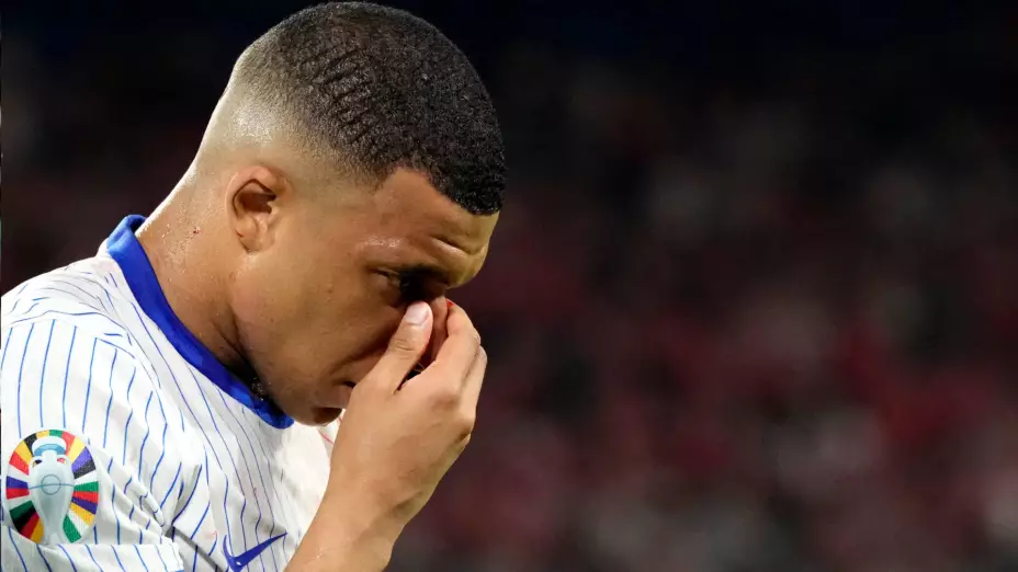 Euro 2024 Kylian Mbappé Nariz Francia 2024