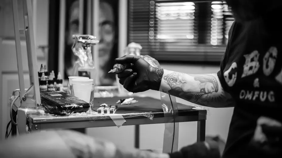 eliminacion de tatuajes enla piel