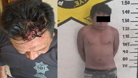 FOTO Sujeto machetea elemento de la Policía Municipal de Seyé