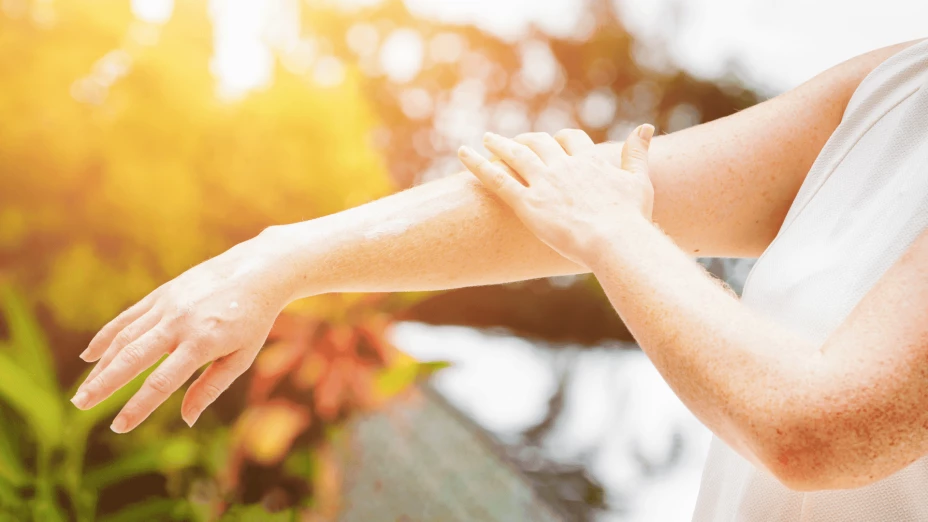 Cáncer de piel unnamed (15).png