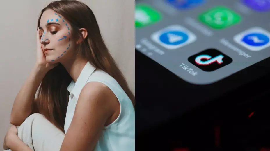 cirugias-esteticas-tik-tok-filtros-bold-glamour