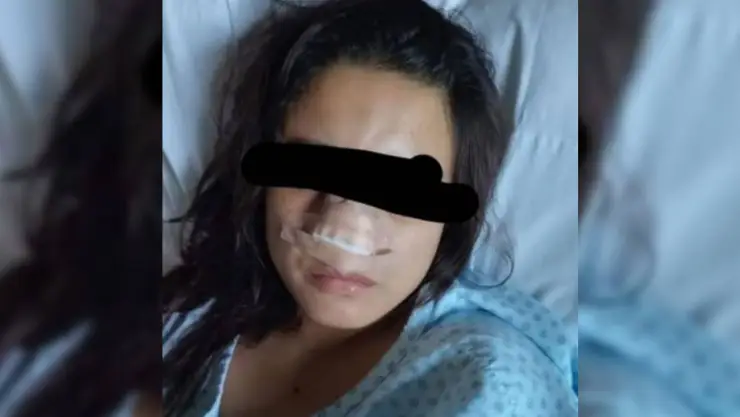 Hombre muerde y arranca la nariz de su esposa en Veracruz