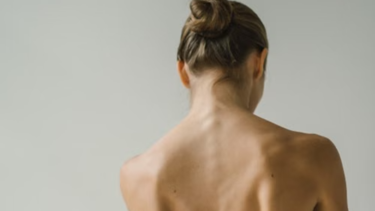 ¿Cómo eliminar los granitos de los brazos y la espalda antes de usar vestidos o trajes de baño?