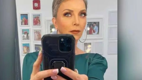 Laura Flores sufre un accidente doméstico: ¿Qué fue lo que pasó?