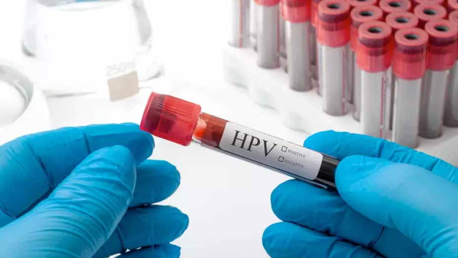 vph