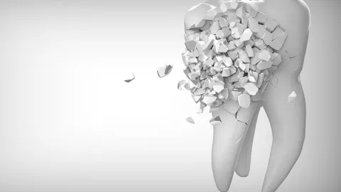 La nueva tendencia para eliminar el sarro de tus dientes