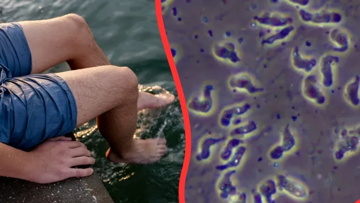 ¿Amiba comecerebros? Estos son los síntomas de la enfermedad