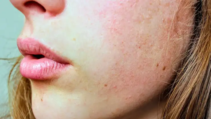 piel skin.jpg