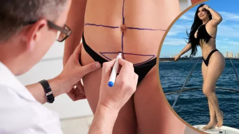 cirugía estética por cundina