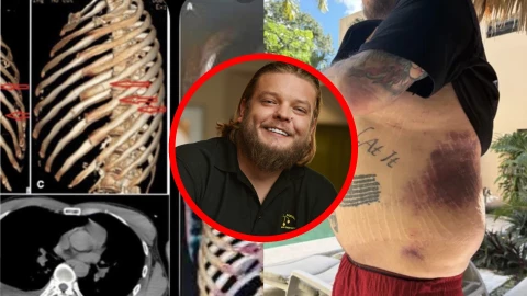 Así fue el BRUTAL accidente de Corey Harrison, de ‘El precio de la Historia’, en Tulum: Estas fueron TODAS sus heridas