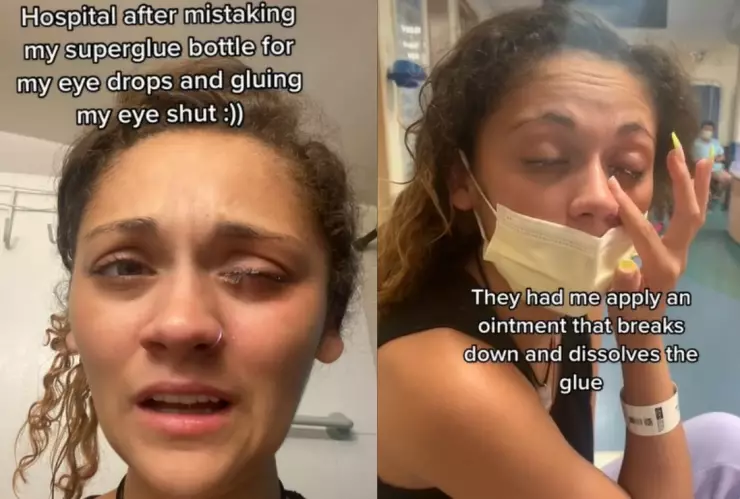 VIDEO Joven confundió gotas para ojos con pegamento, ¡Fue horrible!