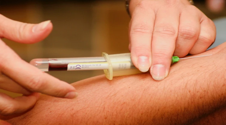 Cuál-tipo-sangre-difícil-conseguir-sangre-dorada