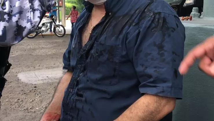 Herido por lugar de estacionamiento