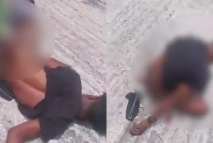 Brasil amputación genital