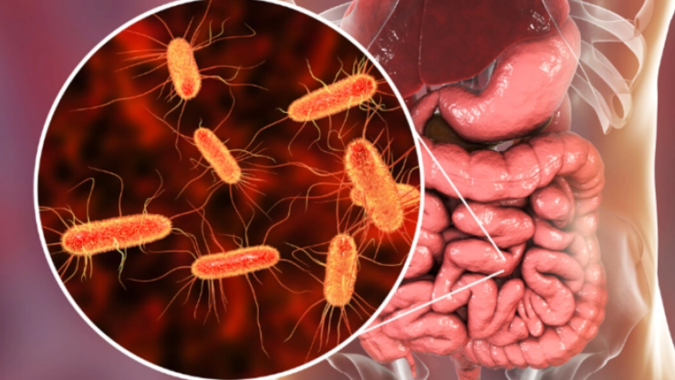 Autoridades sanitarias en ALERTA por brote de infecciones por bacteria E.coli
