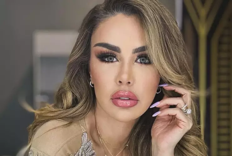 ninel conde criticada exceso filtro