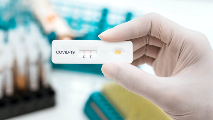 Inicia la aplicación de pruebas rápidas de antígenos para detectar COVID-19 en la CDMX