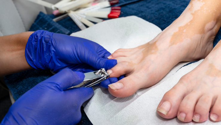 Forma correcta de cortarse las uñas de los pies