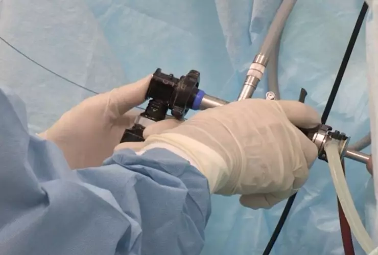 Cáncer-de-pene-Por-qué-es-letal-según-la-UNAM