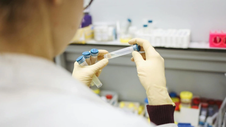 Análisis virus Marburgo OMS